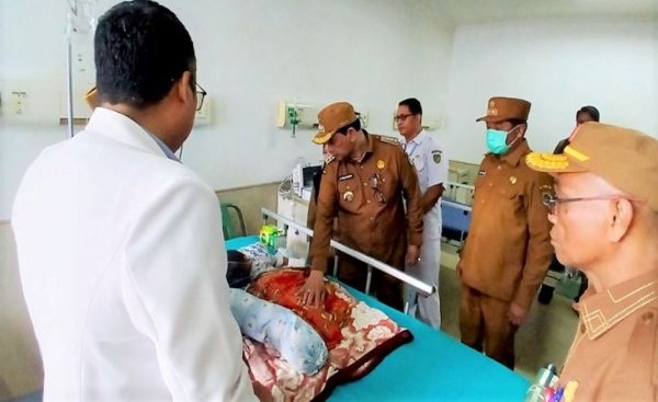 0902.Pemkab Barito Utara Dukung Penuh Pengobatan Bayi Penderita Hidrosefalus